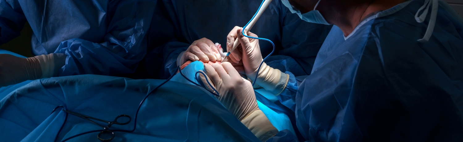 Cirugía Bucal 1 - Clínica Dental Eurodent