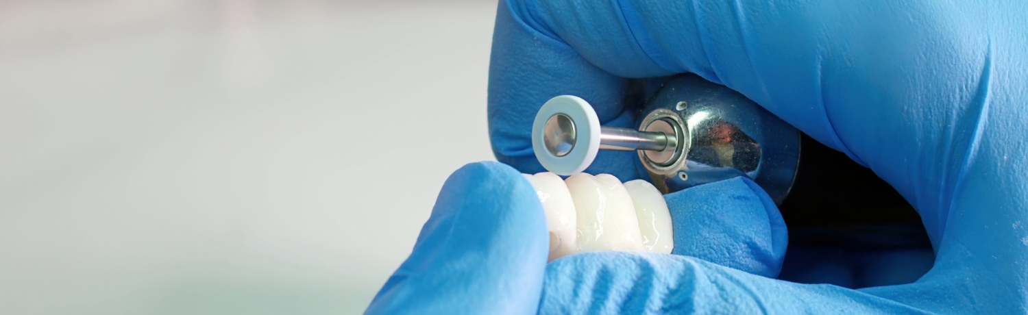 Prótesis Dentales 1 - Clínica Dental Eurodent